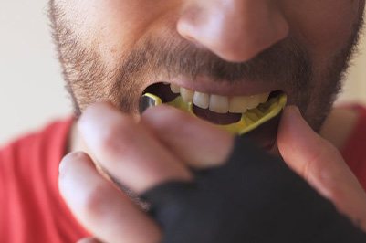 Close up of man inserting a sports mouthguard